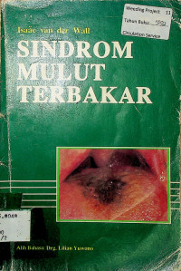 SINDROM MULUT TERBAKAR = The burning mouth syndrome