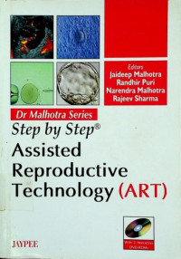 Step by Step® Assisted Reproductive Technology (ART)