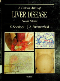 A Colour Atlas of LIVER DISEASE, Second Edition