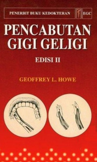 PENCABUTAN GIGI GELIGI ( The extraction of teeth ) EDISI II