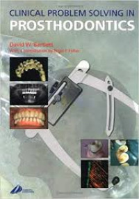 CLINICAL PROBLEM SOLVING IN PROSTHODONTICS