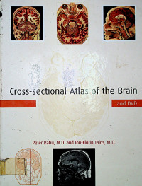 Cross-sectional Atlas of the Brain
