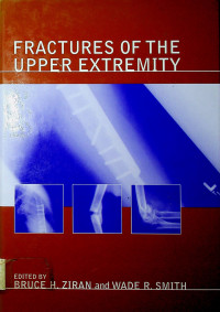 FRACTURES OF THE UPPER EXTREMITY