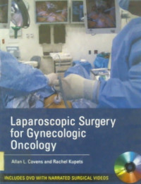 Laparoscopic Surgery for Gynecologic Oncology