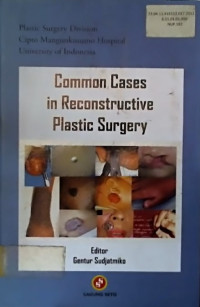 Common Cases in Reconstructive Plastic Surgery