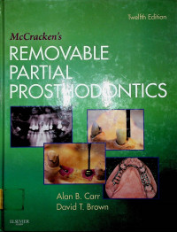 McCracken's REMOVABLE PARTIAL PROSTHODONTICS Twelfth Edition