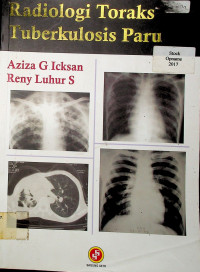Radiologi Toraks Tuberkulosis Paru