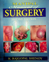 MANIPAL Manual of SURGERY, SECOND EDITION