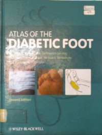 Atlas of the Diabetic Foot, Second Edition