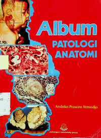 ALBUM PATOLOGI ANATOMI