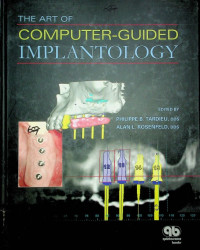 THE ART OF COMPUTER-GUIDED IMPLANTOLOGY