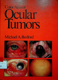 Color Atlas of Ocular Tumors