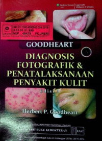 GOODHEART DIAGNOSIS FOTOGRAFIK & PENATALAKSANAAN PENYAKIT KULIT