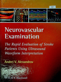 Neurovascular Examination: The Rapid Evalution of Stroke Patients Using Ultrasound Waveform Interpretation