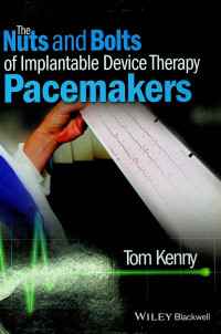 The Nuts and Bolts of Implantable Device Therapy Pacemakers