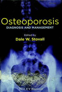 Osteoporosis; DIAGNOSIS AND MANAGEMENT