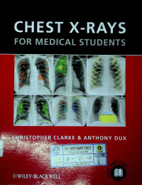 CHEST X- RAYS FOR MEDICAL STUDENTS