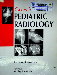 Cases in Pediatric Radiology: 200 Cases (Common Diseases)