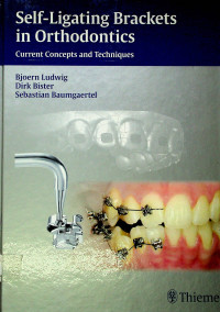 Self-Ligating Brackets in Orthodontics: Current Concepts and Techniques