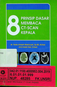 8 PRINSIP DASAR MEMBACA CT- SCAN KEPALA