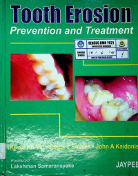 Tooth Erosion: Prevention and Treatment