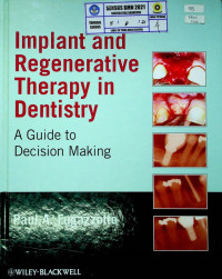 Implant and Regenerative Therapy in Dentistry: A Guide to Decision Making