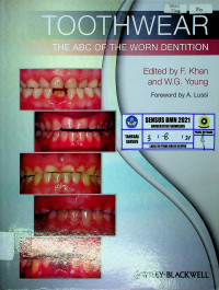 TOOTHWEAR: THE ABC OF THE WORN DENTITION