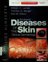 Adrews` Diseases OF THE Skin Clinical Dermatology, ELEVENTH EDITION