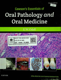 Cawson's Essentials of Oral Pathology and Oral Medicine, Ninth Edition