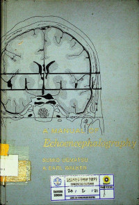 A MANUAL OF Echoencephalography