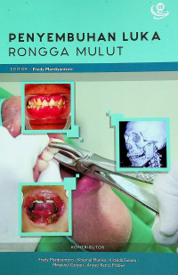 PENYEMBUHAN LUKA RONGGA MULUT