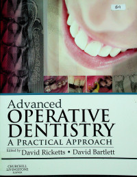 Advanced OPERATIVE DENTISTRY A PRACTICAL APPROACH
