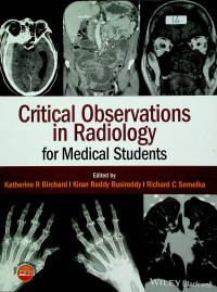 Critical Observations In Radiology for Medical Students