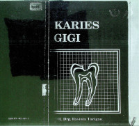 KARIES GIGI