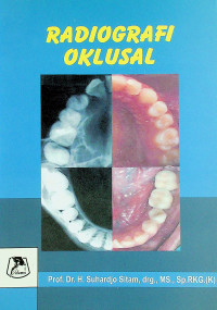 RADIOGRAFI OKLUSAL