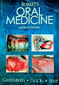 BURKET'S ORAL MEDICINE, ELEVENTH EDITION