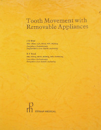 Tooth Movement with Removable Appliances