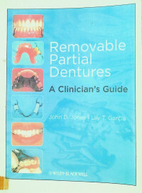 Removable Partial Denture: A Clinician's Guide