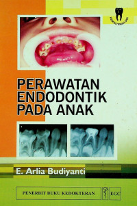 PERAWATAN ENDODONTIK PADA ANAK