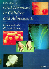 Color Atlas of Oral Diseases in Children and Adolescents