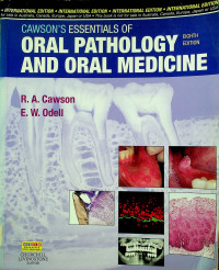 CAWSON`S ESSENTIALS OF ORAL PANTHOLOGY AND ORAL MEDICINE, EIGHTH EDITION