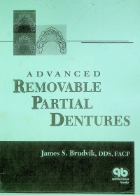 ADVANCED REMOVABLE PARTIAL DENTURES