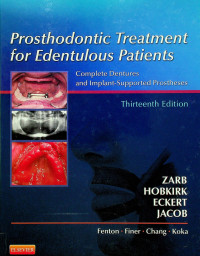 Prosthodontic Treatment for Edentulous Patients: Complete Dentures and Implant-Supported Prostheses, Thirteenth Edition