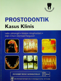 PROSTODONTIK: Kasus Klinis