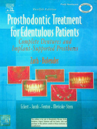 Prosthodontic Treatment for Edentulous Patients: Complete Dentures and Implant-Supported Prostheses, Twelfth Edition