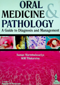 ORAL MEDICINE & PATHOLOGY: A Guide to Diagnosis and Management