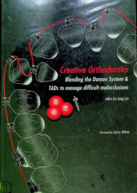 Creative Orthodontics Blending the Damon System & TADs to manage difficult malocclusion