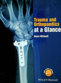 Trauma and Othopaedics at a Glance