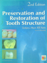 Preservation and Restoration of Tooth Structure, 2nd Edition