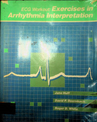 ECG Workout: Exercises in Arrhythmia Interpretation